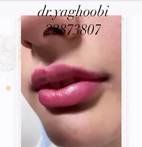دکتر خلیل یعقوبی (متخصص پوست، مو و زیبایی)