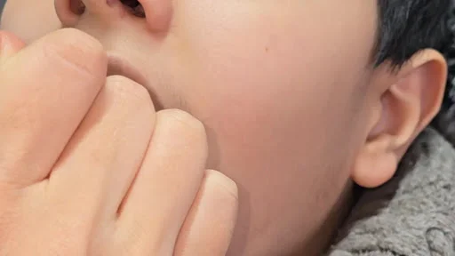 آذربایجان گفتاردرمانی