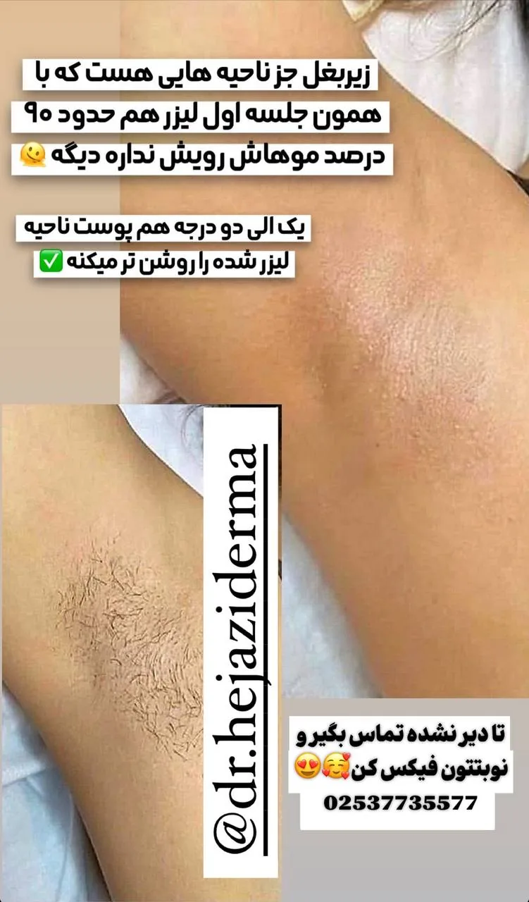 مرکز لیزر دکتر سمیه حجازی
