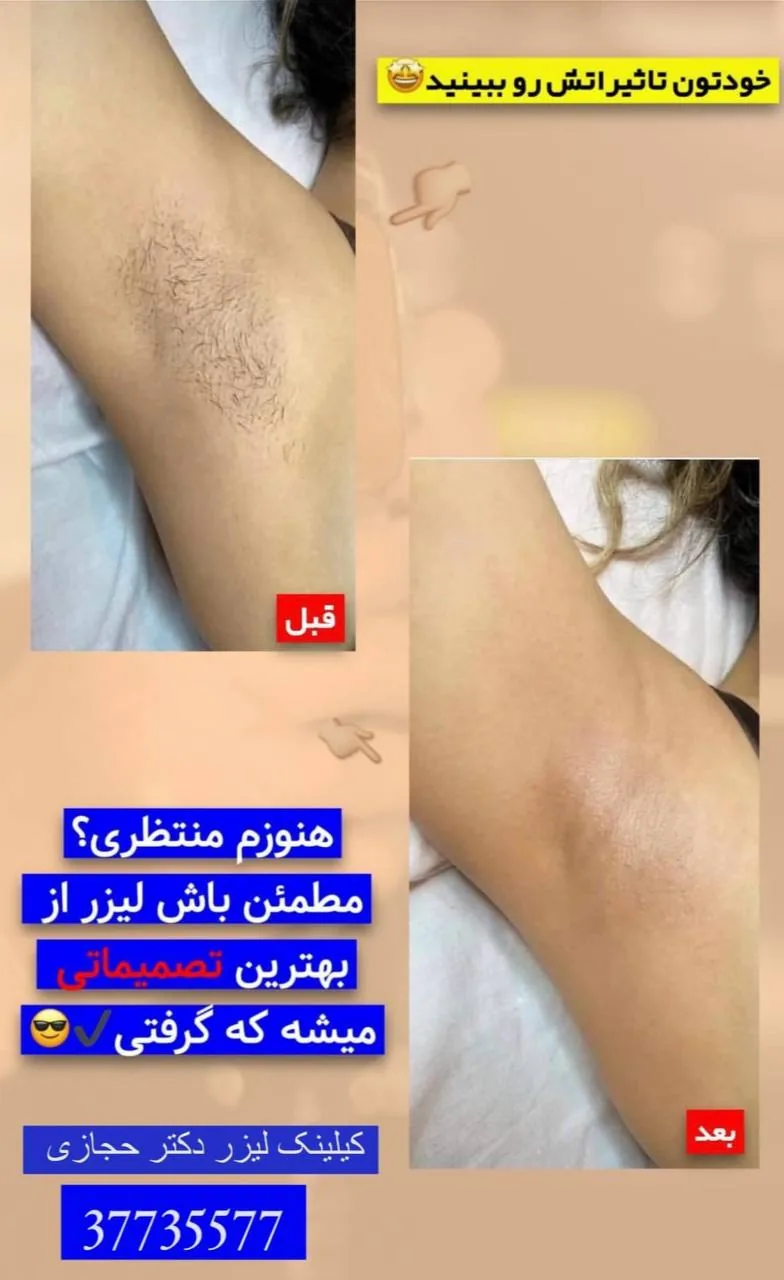 مرکز لیزر دکتر سمیه حجازی - تصویر 2