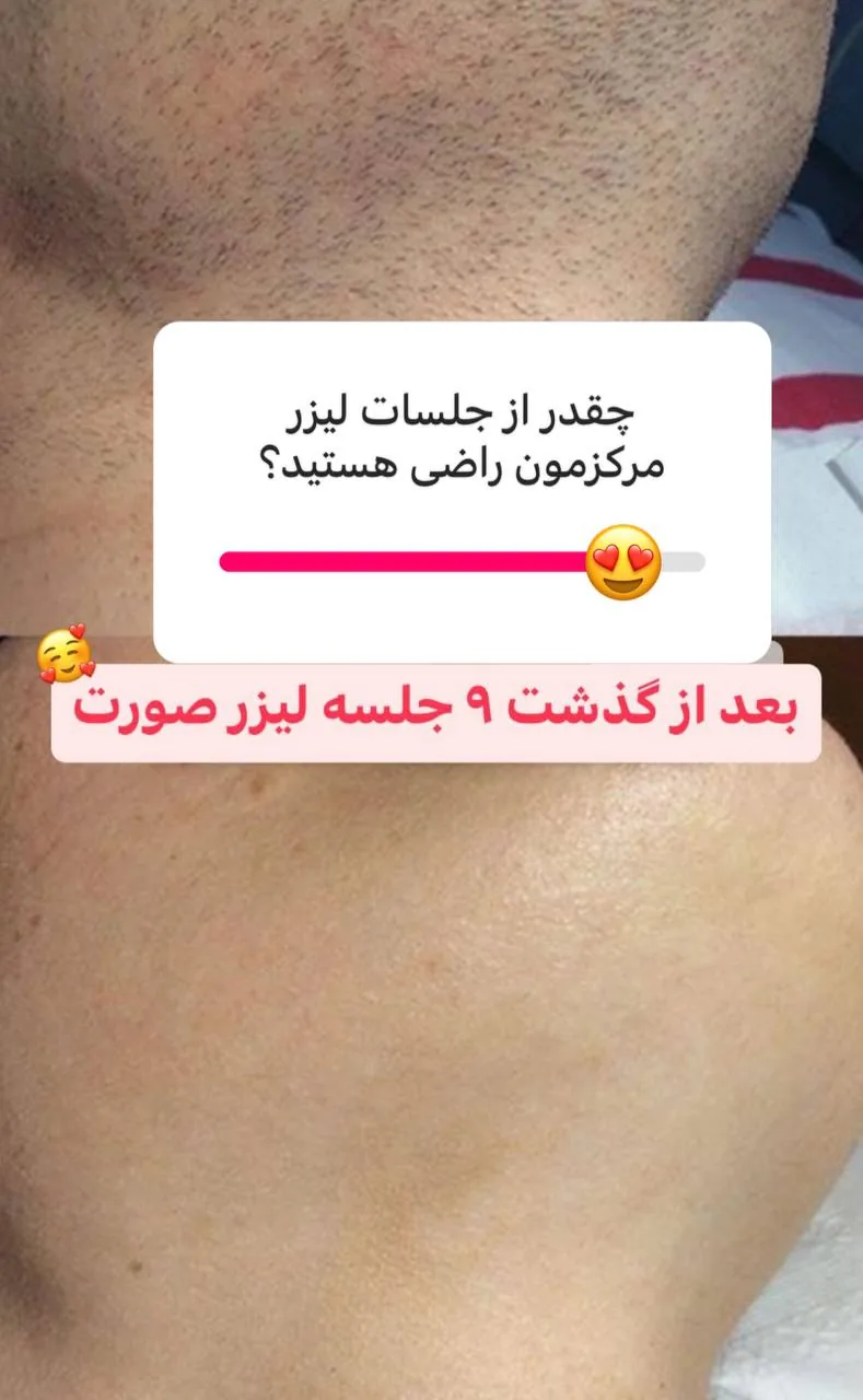 مرکز لیزر دکتر سمیه حجازی - تصویر 3