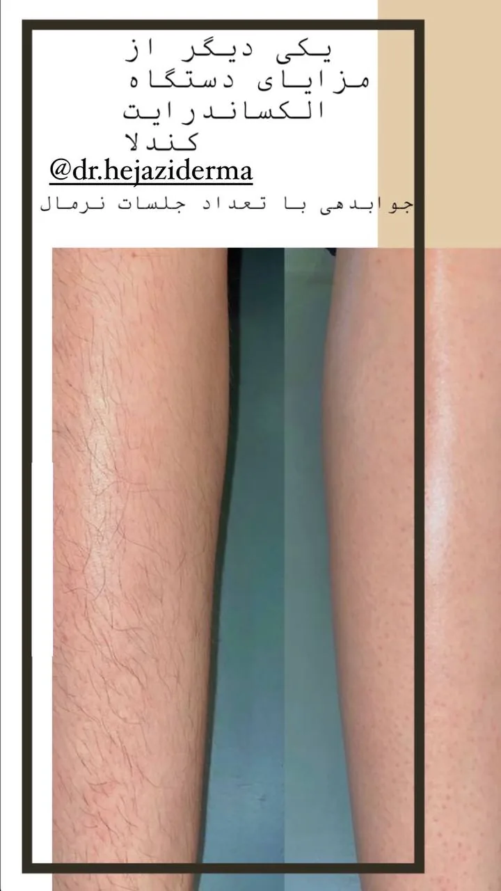 مرکز لیزر دکتر سمیه حجازی - تصویر 4