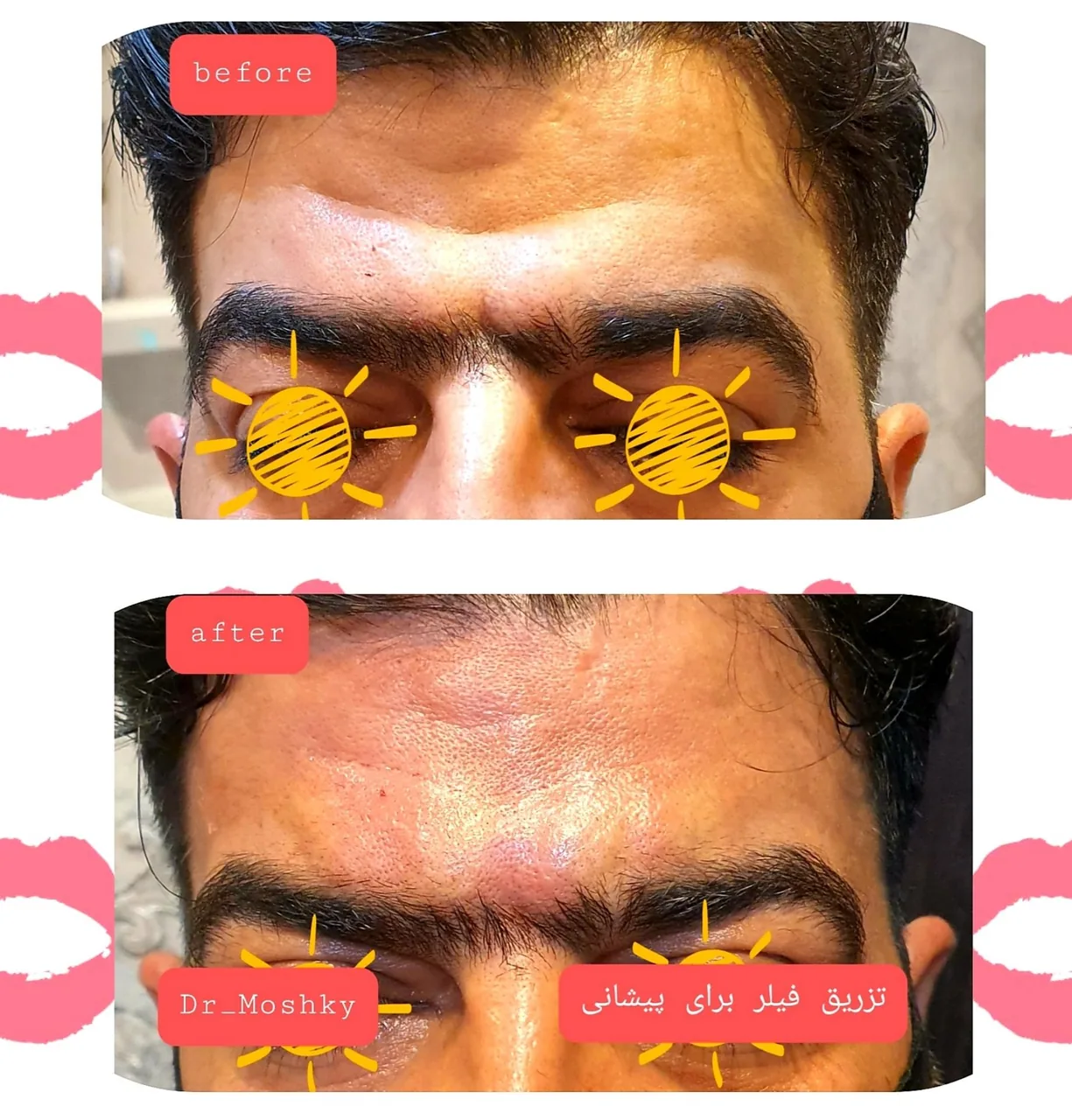 مرکز تخصصی پوست و لیزر و زیبایی (دکتر حمید مشکی) - تصویر 3