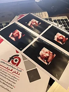 سونوگرافی و رادیولوژی دکتر فرجی