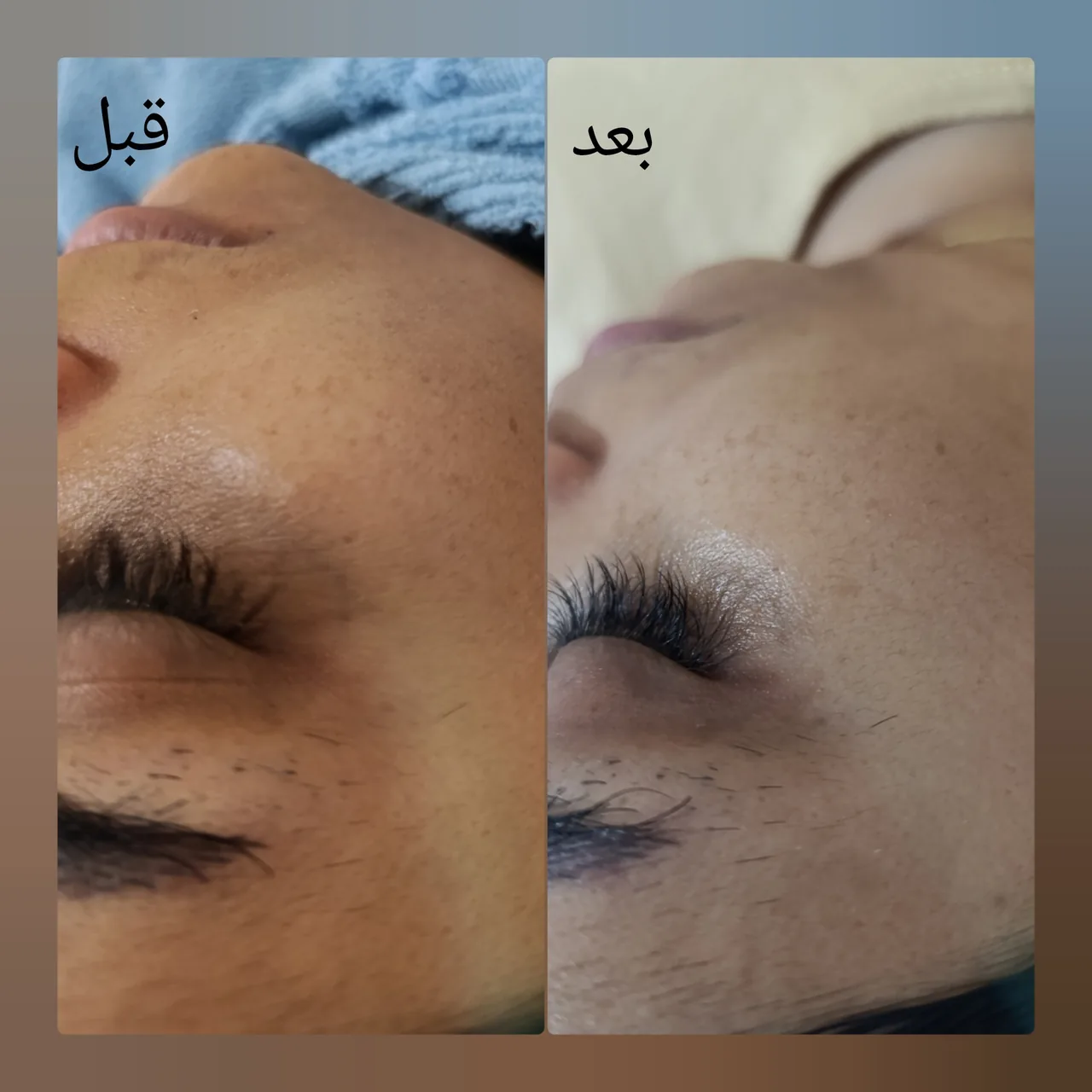 خدمات تخصصی پوست  سمیه اکرمی - تصویر 4