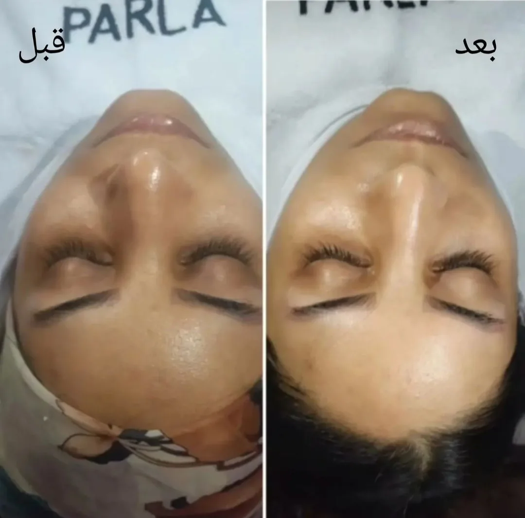 خدمات تخصصی پوست  سمیه اکرمی - تصویر 5