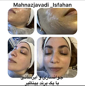 خدمات تخصصی  پوست و مو  مهناز جوادی