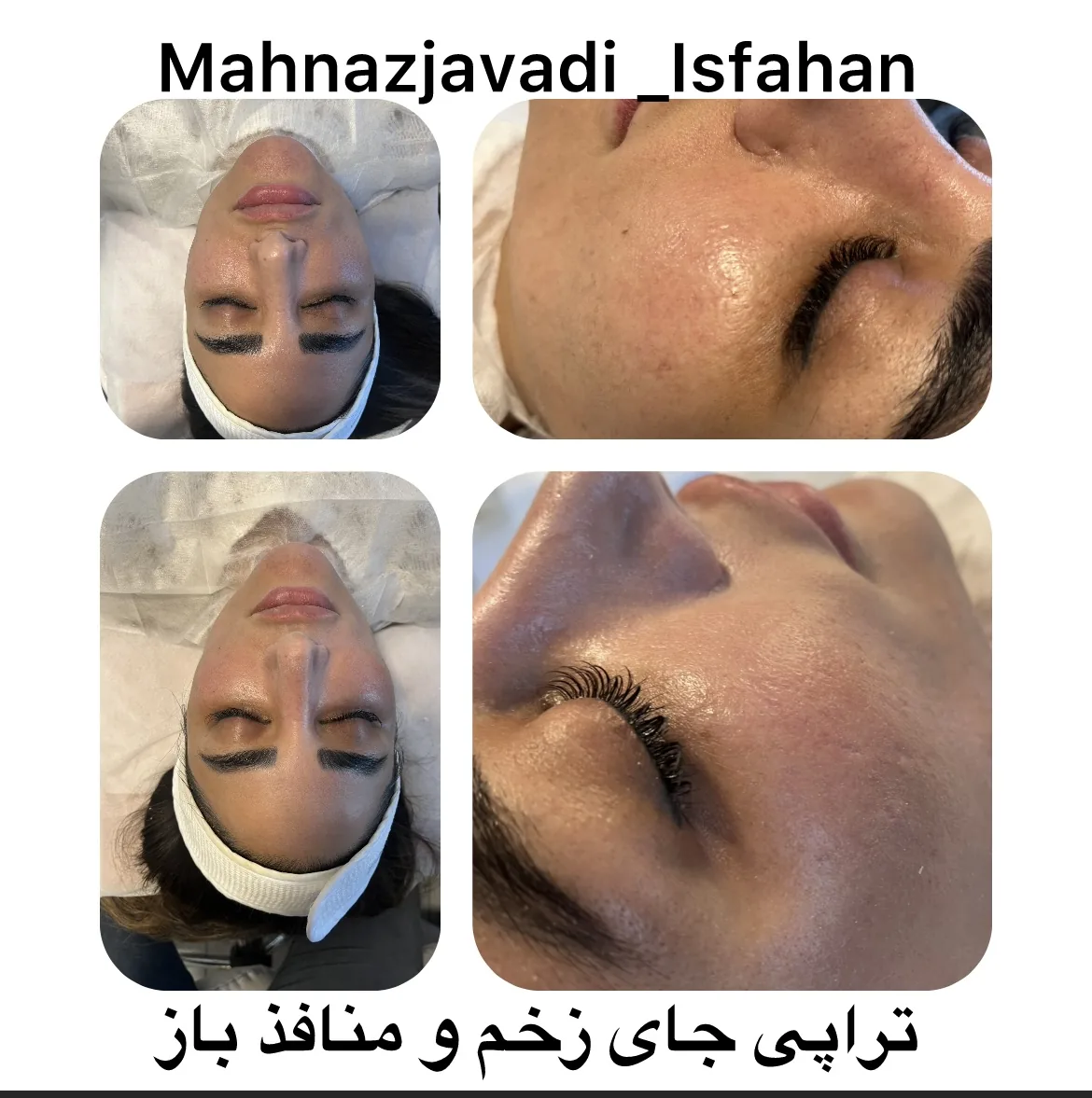 خدمات تخصصی  پوست و مو  مهناز جوادی - تصویر 3