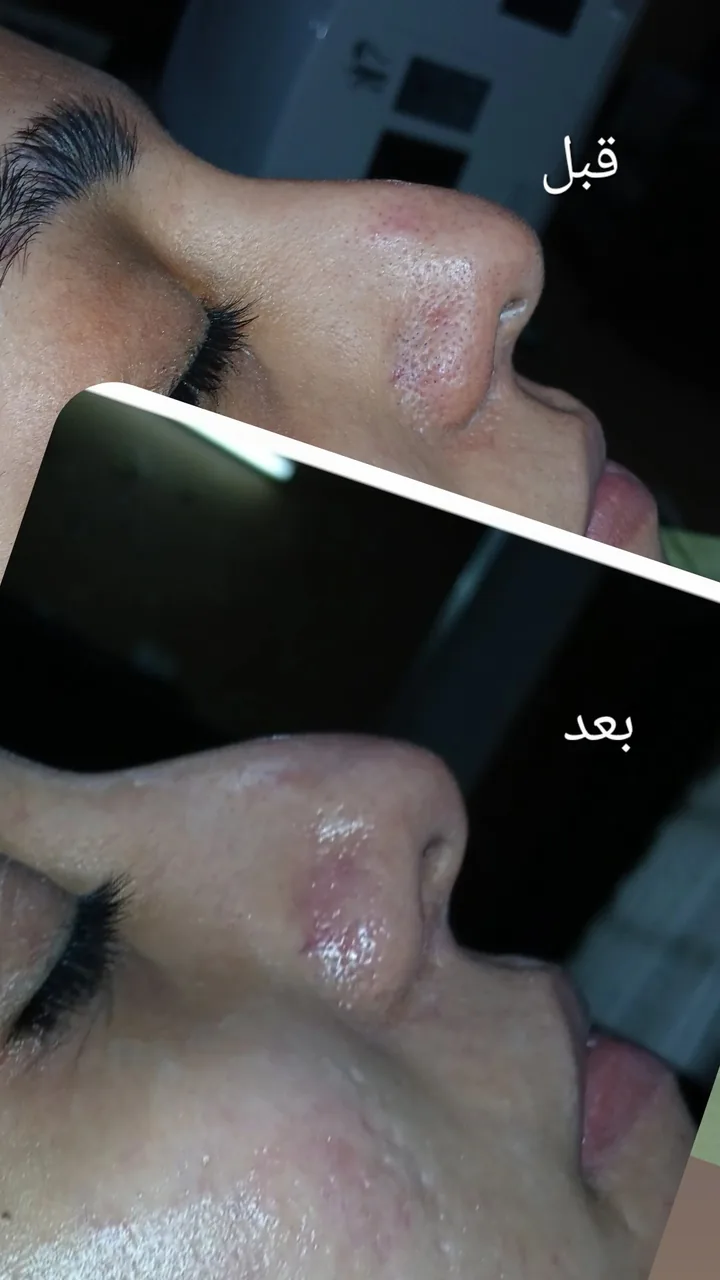خدمات تخصصی پاکسازی پوست و فیشال نگاره