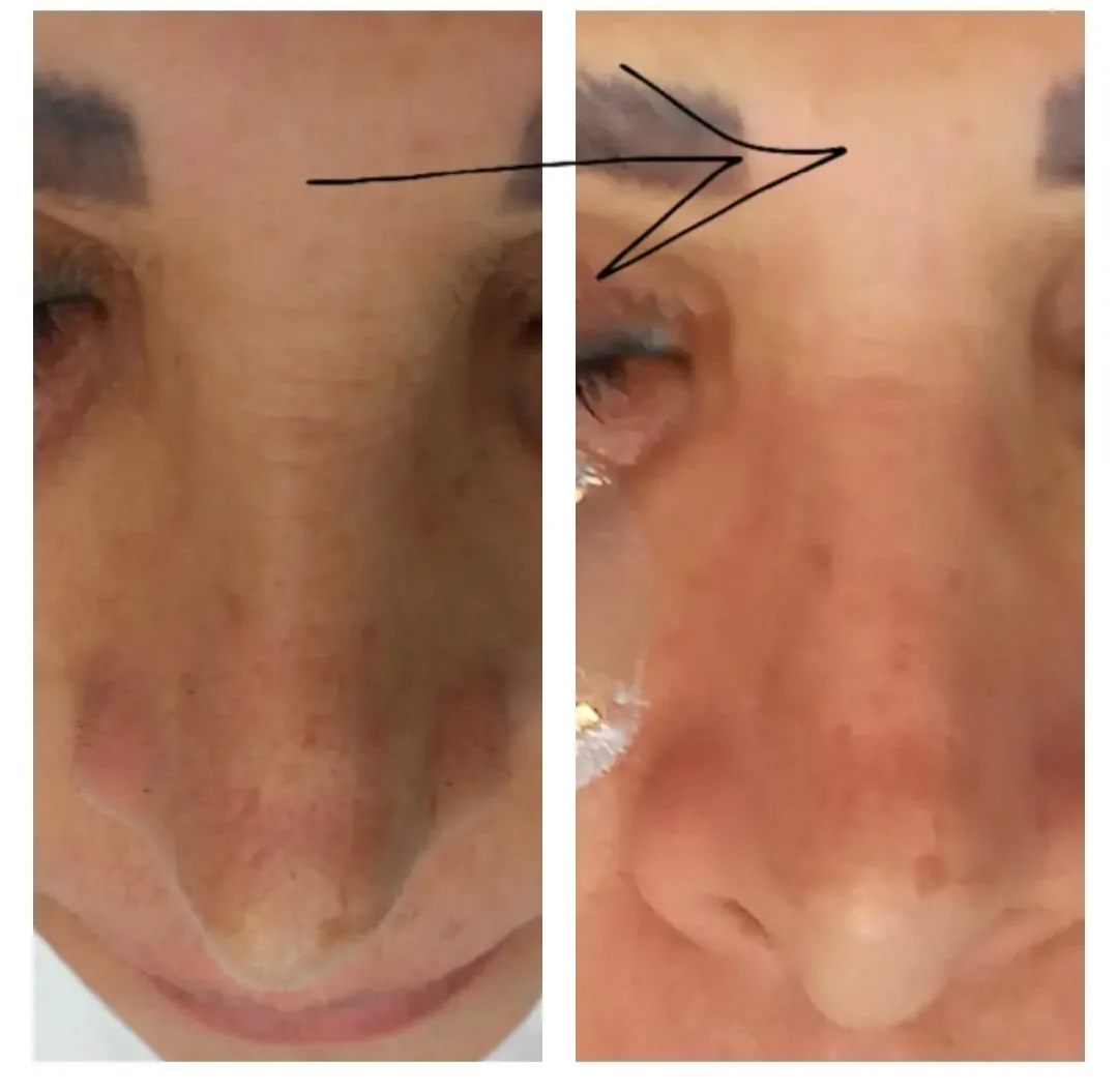 خدمات تخصصی پاکسازی پوست و فیشال نگاره - تصویر 2