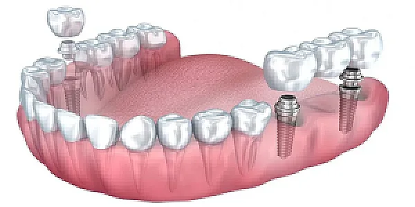 دندانپزشکی مطب دکتر هدیه هدایت زاده