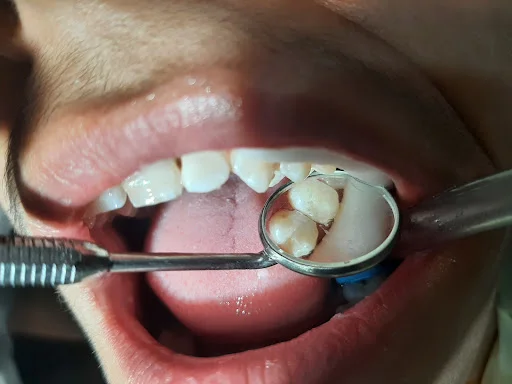 مرکز دندانپزشکی دکتر پریسا پرکار