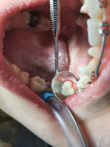 مرکز دندانپزشکی دکتر پریسا پرکار