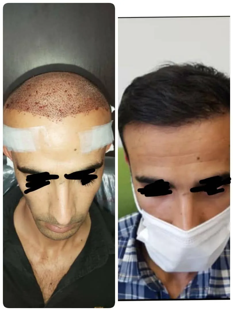 کلینیک زیبایی و کاشت دکتر وارث - تصویر 2