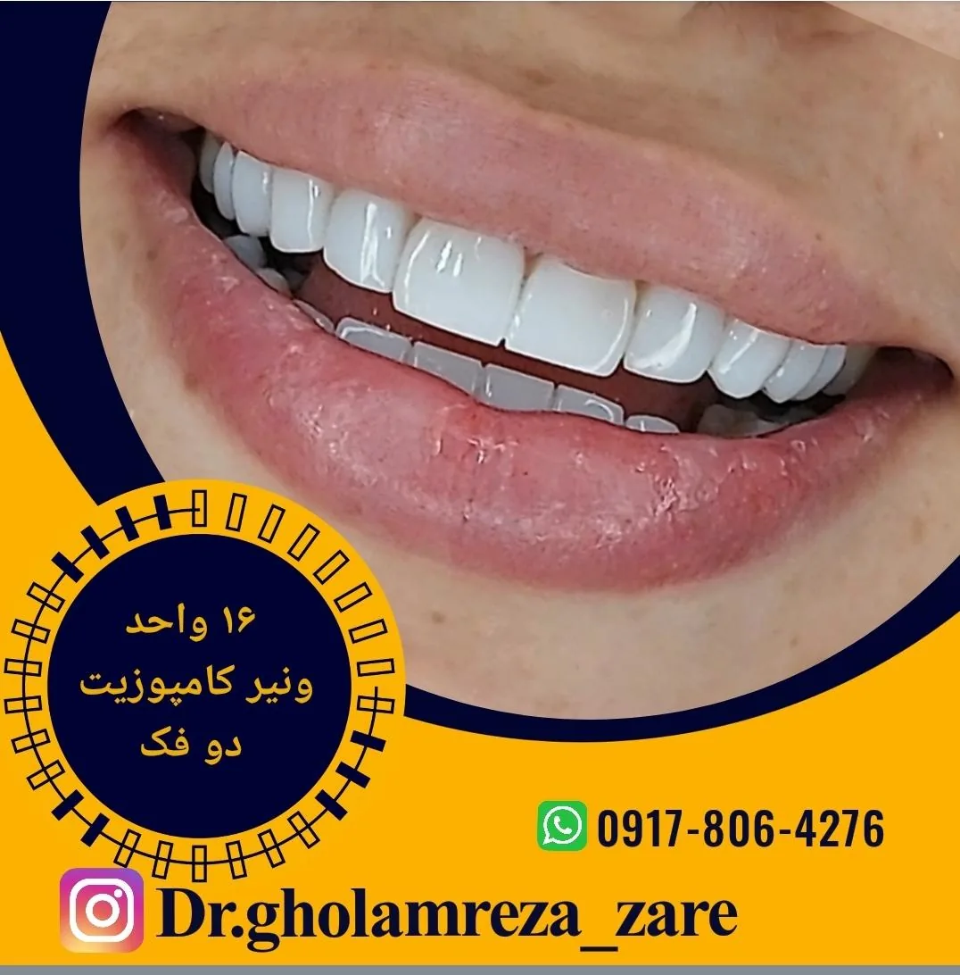 دندانپزشکی دکتر غلامرضا زارع - تصویر 2