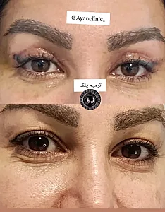 دکتر امیریان | کلینیک زیبایی آیان