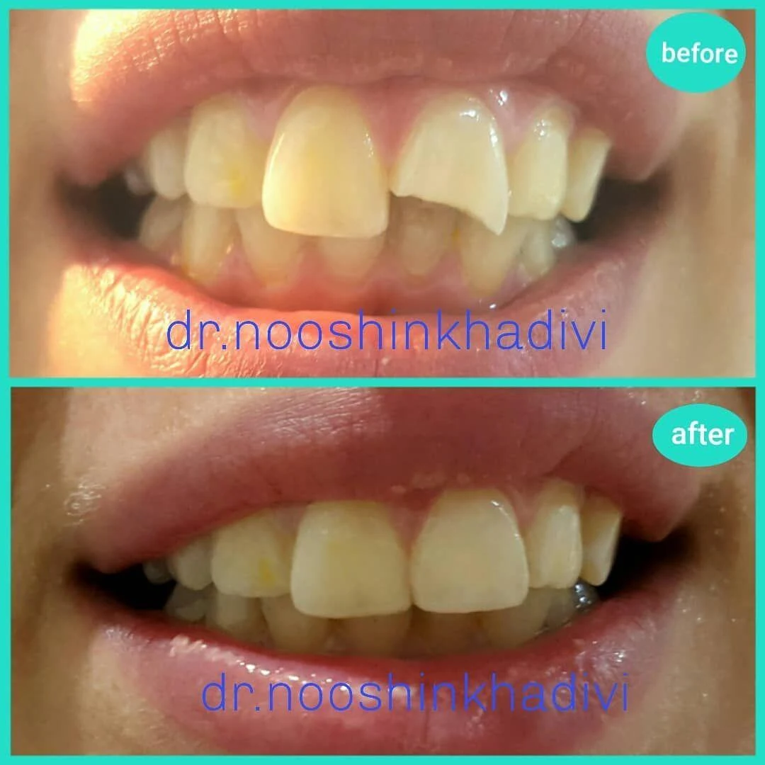 مطب دندانپزشکی دکتر نوشین خدیوی