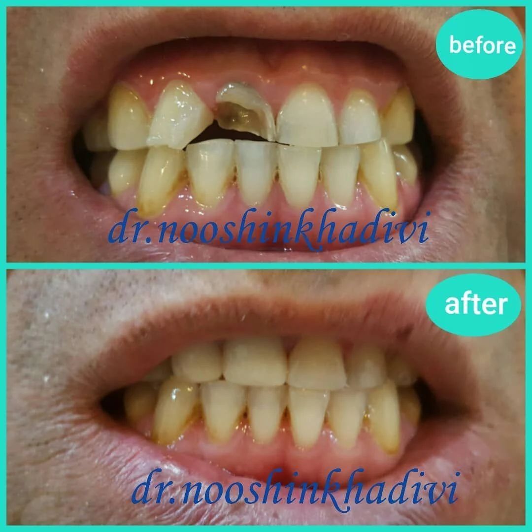 مطب دندانپزشکی دکتر نوشین خدیوی - تصویر 2