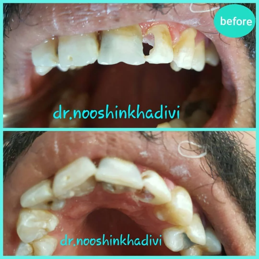 مطب دندانپزشکی دکتر نوشین خدیوی - تصویر 3