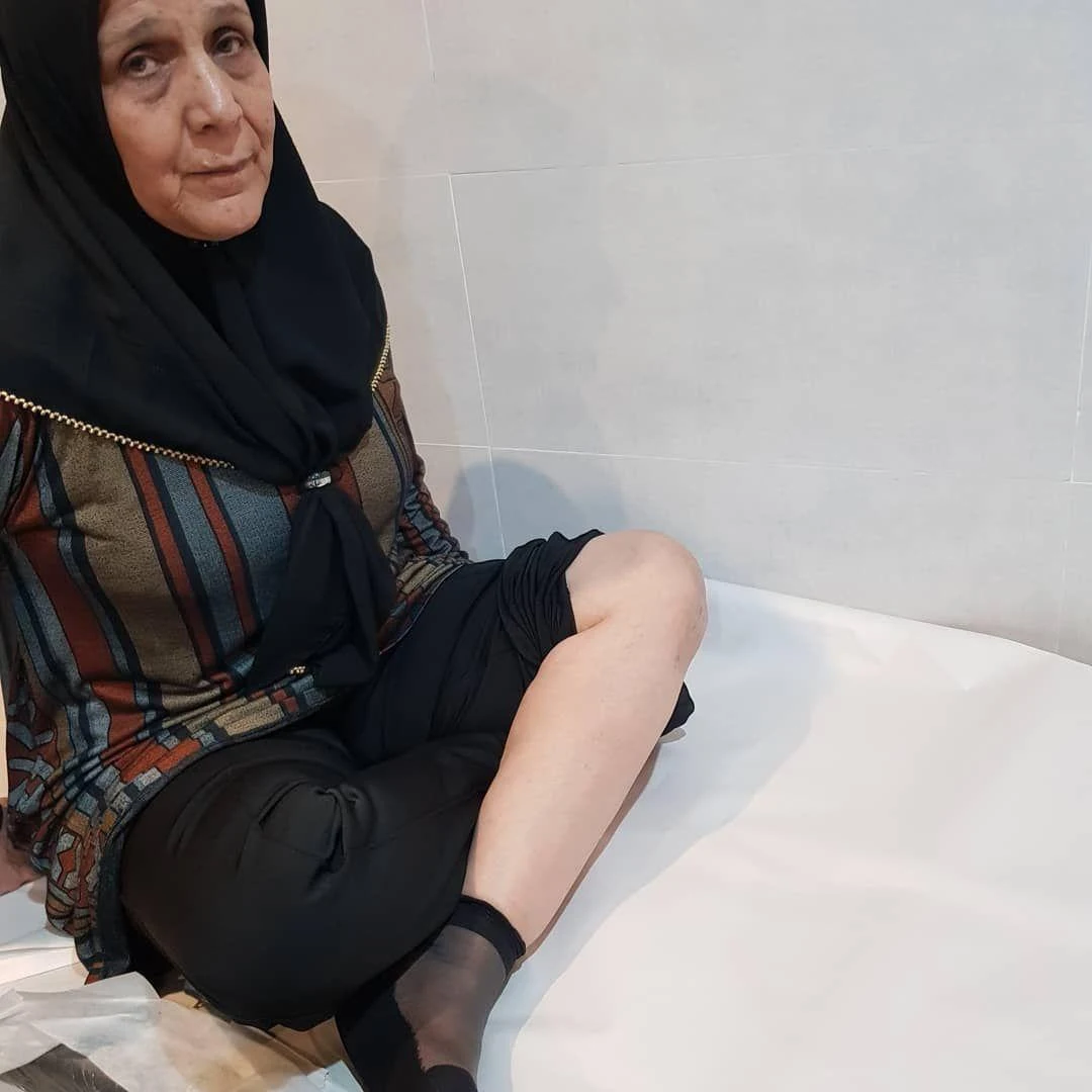 کلینیک دکتر مجید عابدی (متخصص ارتوپدی در شیراز ) - تصویر 3