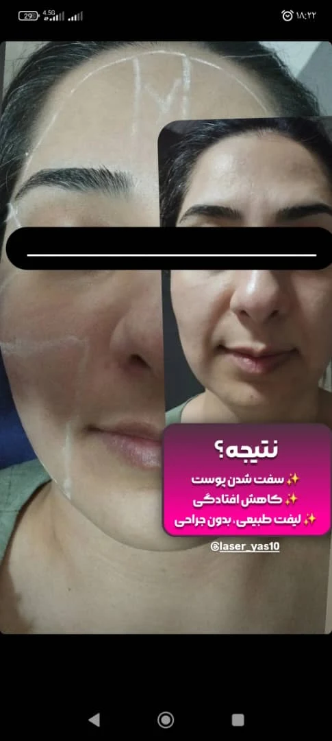 کلینیک زیبایی یاس - تصویر 2