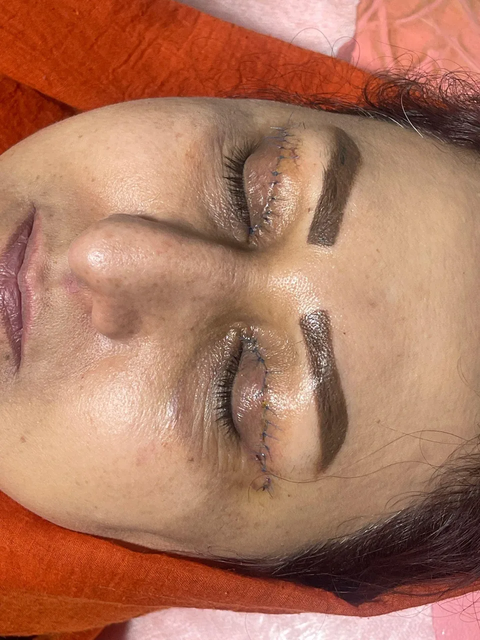 کلینیک پوست مو زیبایی نور - تصویر 4