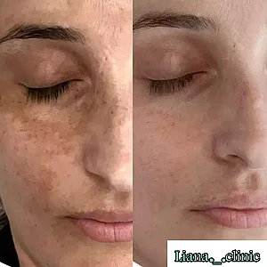کلینیک زیبایی لیانا