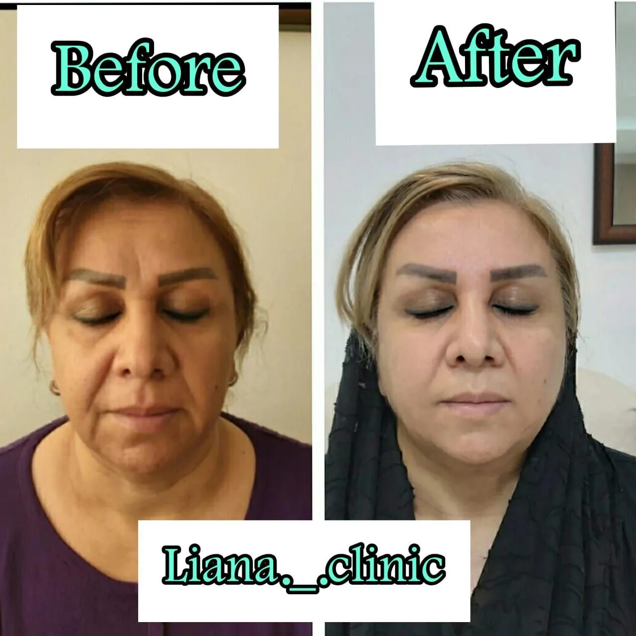 کلینیک زیبایی لیانا - تصویر 4