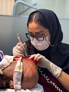 کلینیک کاشت مو تخصصی رستگار