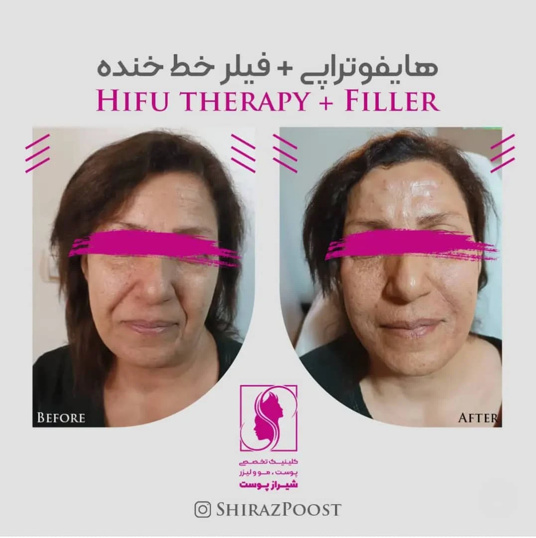 کلینیک زیبایی شیراز پوست - پزشک عمومی در شیراز - تصویر 2