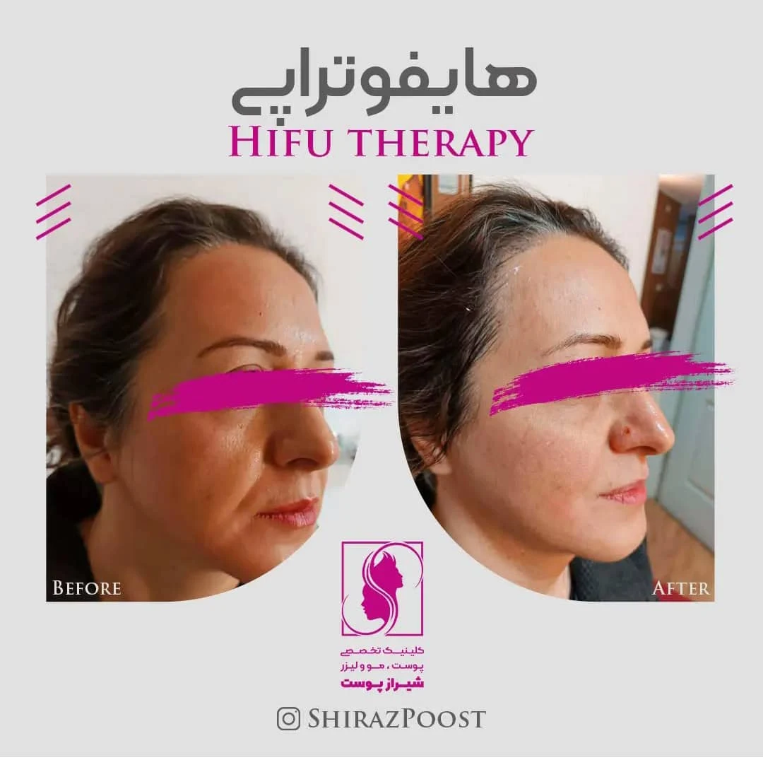 کلینیک زیبایی شیراز پوست - پزشک عمومی در شیراز - تصویر 3