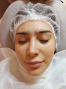 فیشال و پاکسازی پوست نازنین