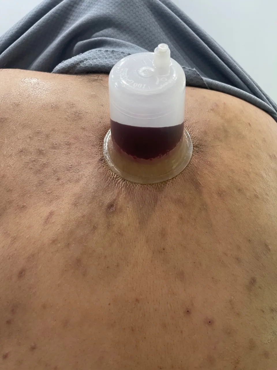کلینیک لیزر و طب سنتی توک - تصویر 2