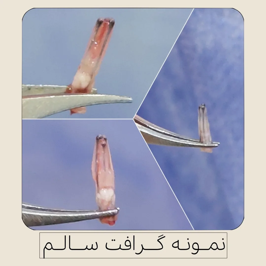 کاشت تخصصی موی طبیعی شهلا - تصویر 2