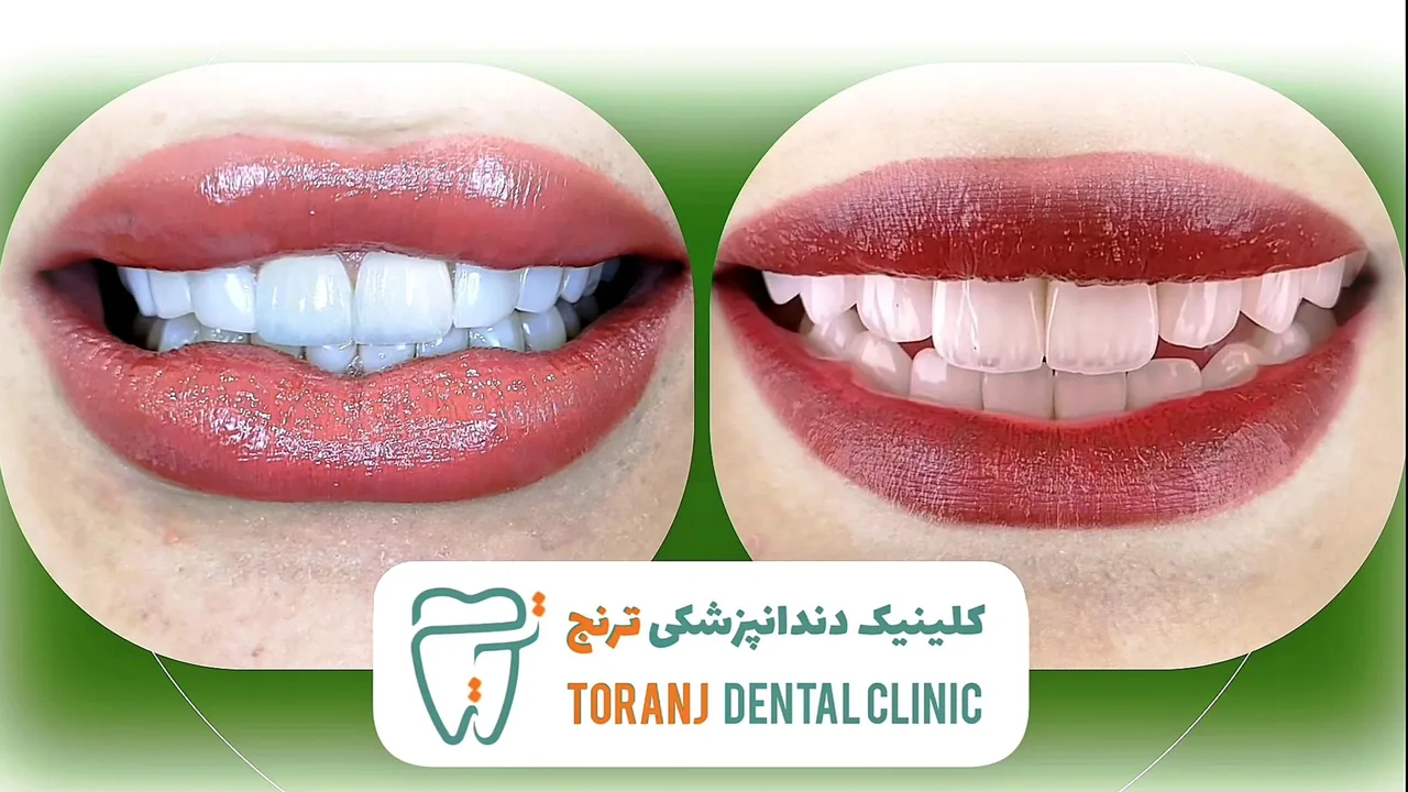 کلینیک دندانپزشکی ترنج - تصویر 4