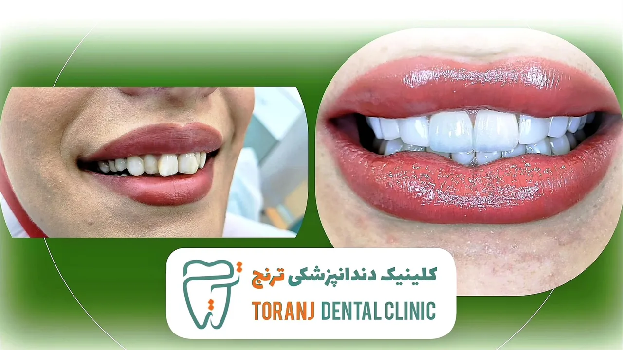 کلینیک دندانپزشکی ترنج - تصویر 5