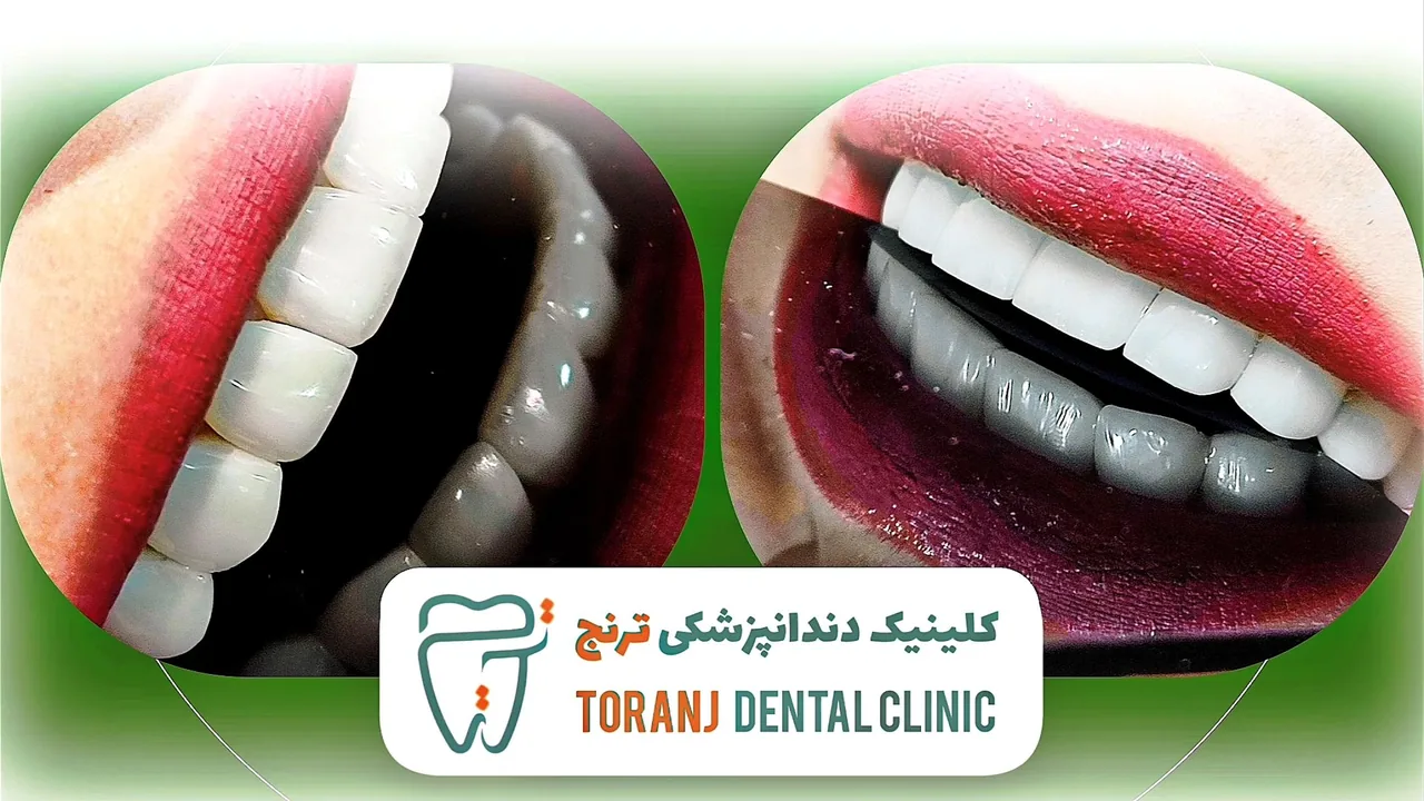 کلینیک دندانپزشکی ترنج - تصویر 6