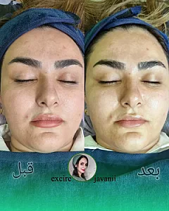 سالن پاکسازی پوست و فیشال تینا