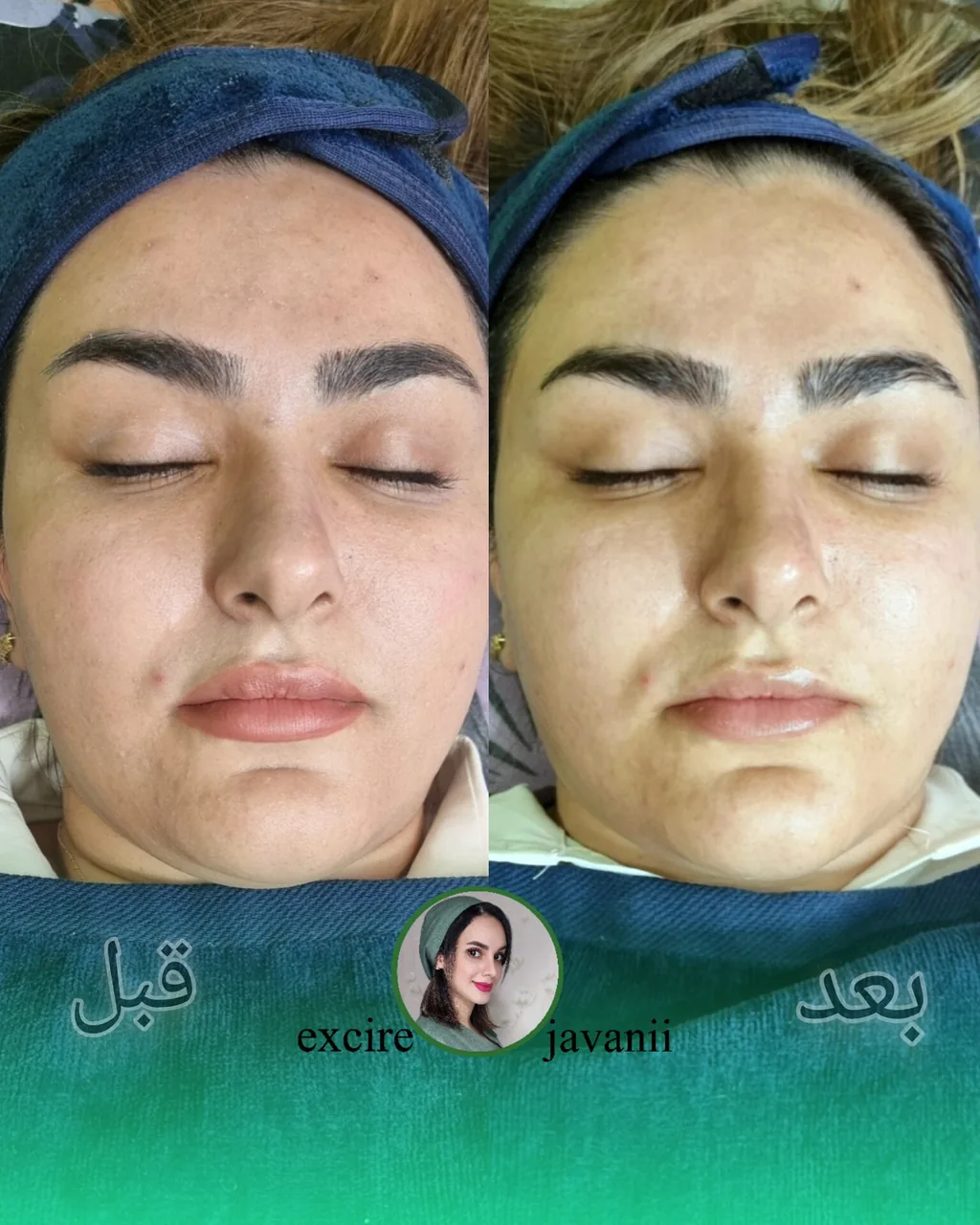 سالن پاکسازی پوست و فیشال تینا