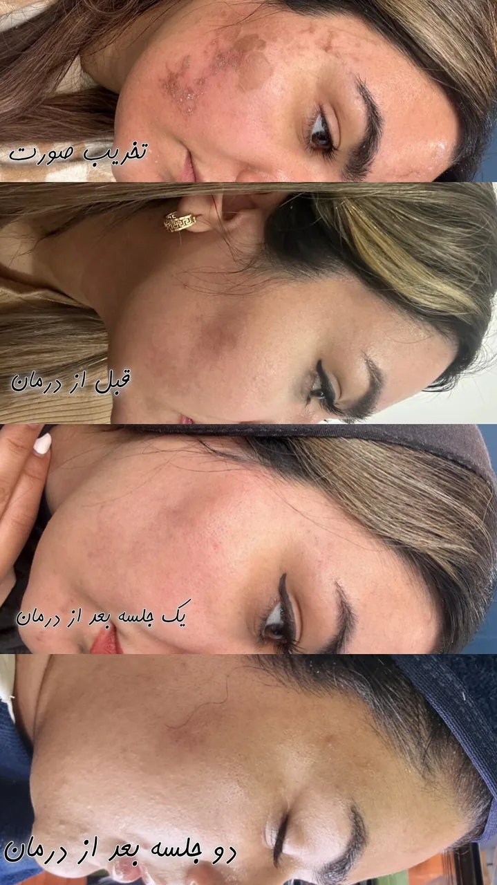 سالن پاکسازی پوست و فیشال تینا - تصویر 2