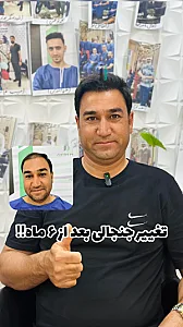 کاشت مو رز