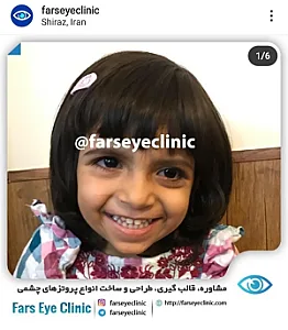 کلینیک ساخت چشم مصنوعی فارس