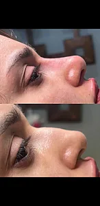 خدمات زیبایی مظفریان