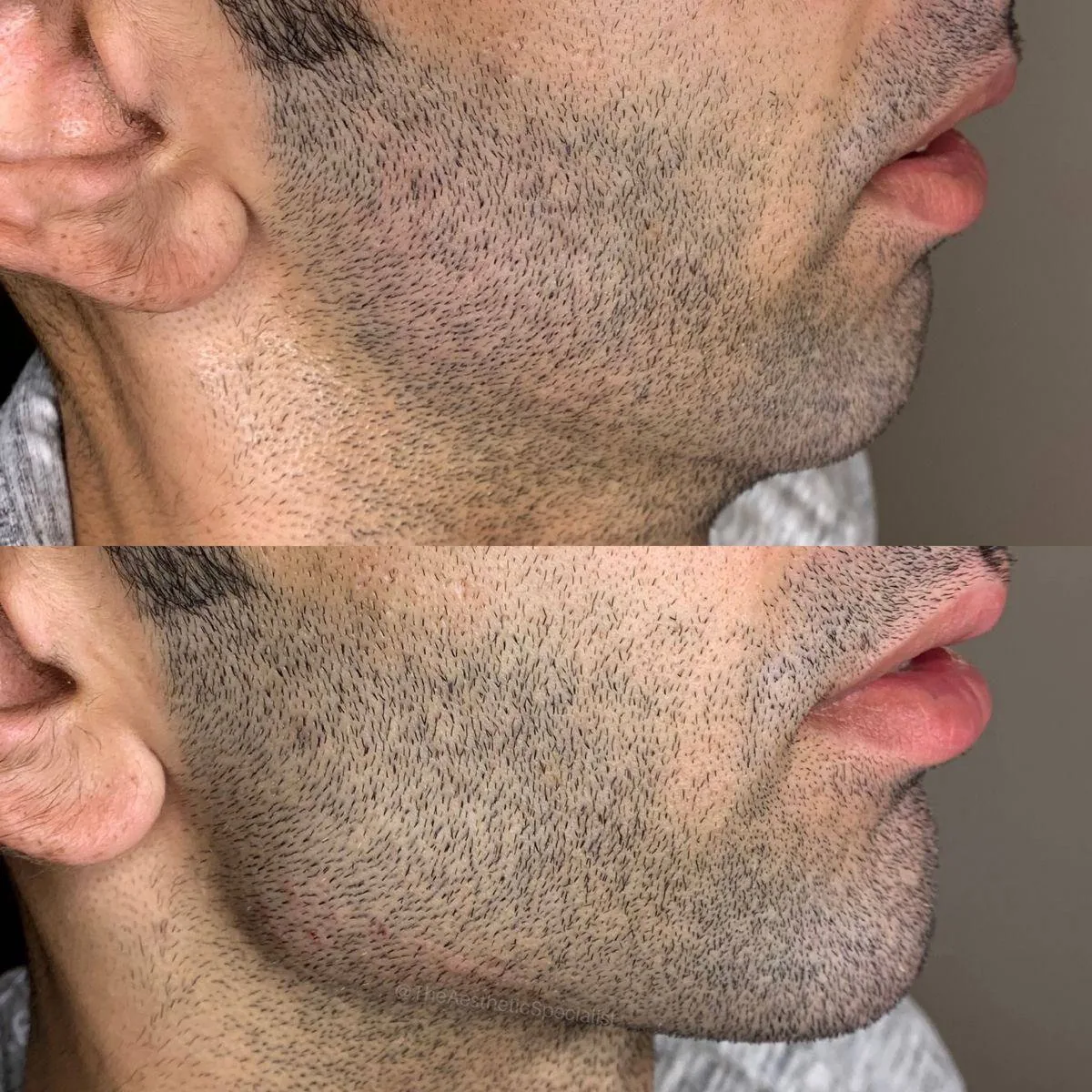 کلینیک تخصصی زیبایی ماه مینا - تصویر 4
