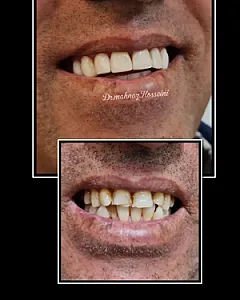 مطب دندانپزشکی دکترمهنازحسینی