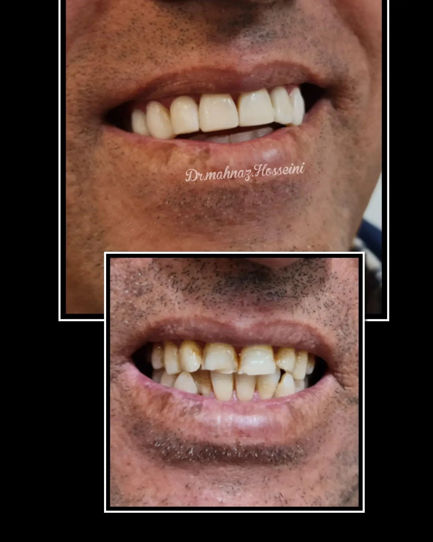مطب دندانپزشکی دکترمهنازحسینی - دندانپزشک در شیراز
