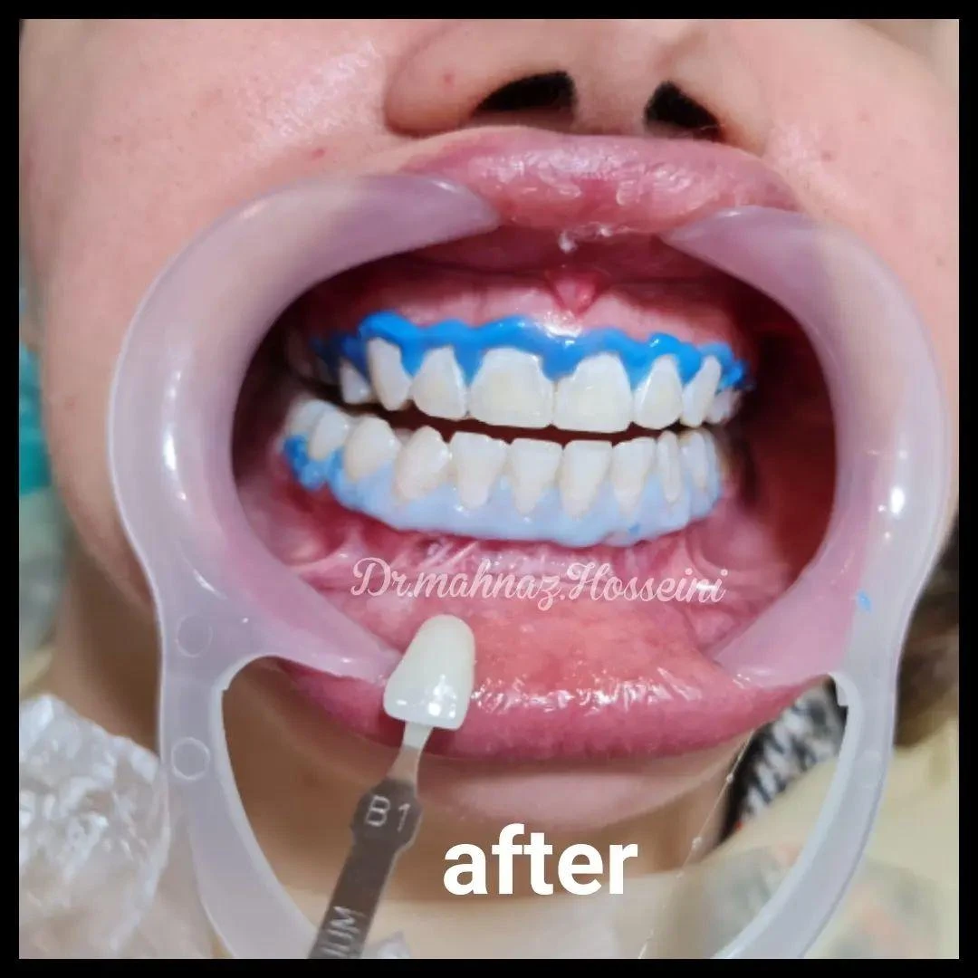 مطب دندانپزشکی دکترمهنازحسینی - دندانپزشک در شیراز - تصویر 3