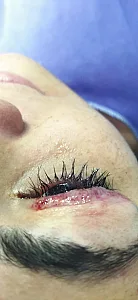 تیم تخصصی کاشت مو هخامنش درکلینیک مارینا