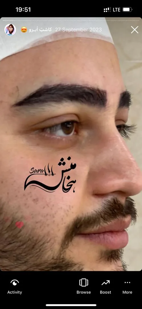 تیم تخصصی کاشت مو هخامنش درکلینیک مارینا - تصویر 6