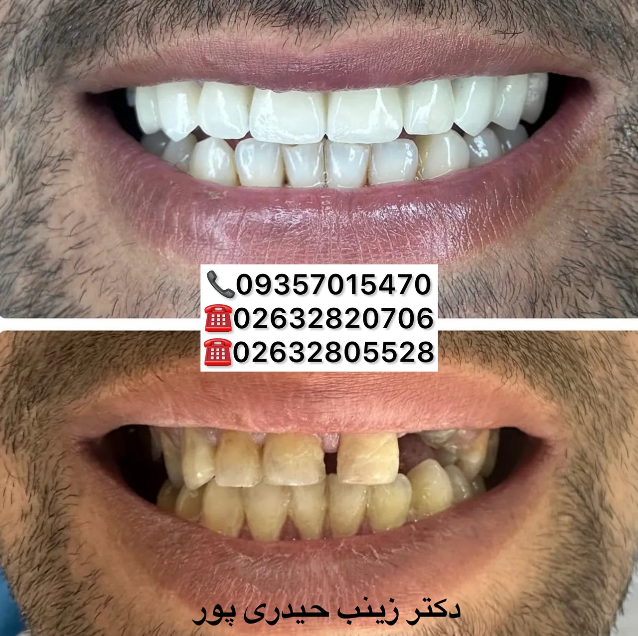 مطب دندانپزشکی تخصصی دکتر زینب حیدری پور - تصویر 4